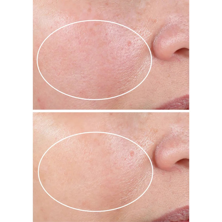 StriVectin Advanced Retinol Nightly Renewal Moisturizer, 1.0 oz, 2-pack