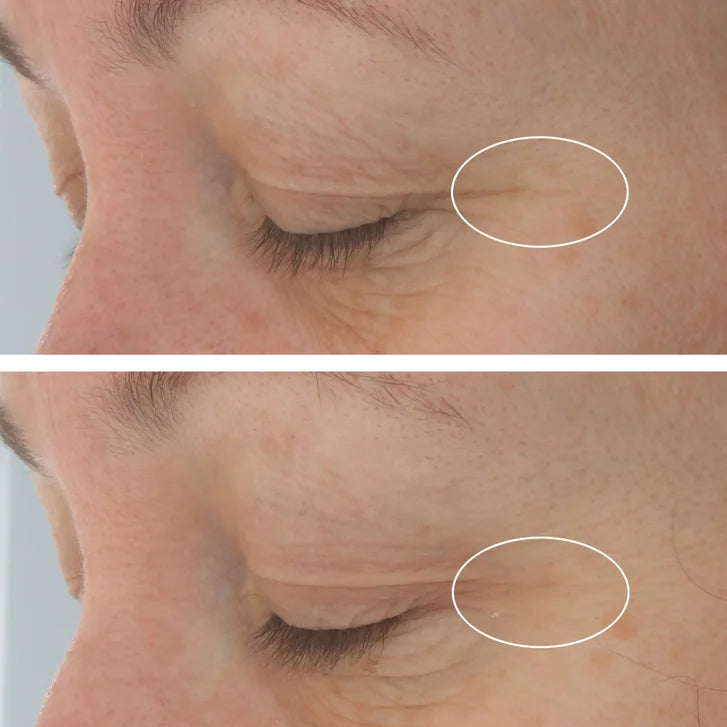 StriVectin Hyaluronic Tripeptide Gel-Cream For Eyes, 0.5 oz, 2-pack