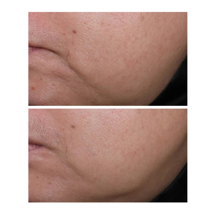 StriVectin Contour Restore Tightening & Sculpting Face Cream, 1 oz, 2-pack