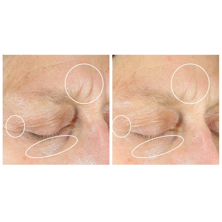 StriVectin Anti-Wrinkle Intensive Eye Concentrate Plus