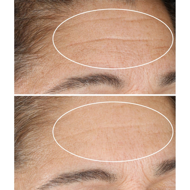 StriVectin Advanced Retinol Nightly Renewal Moisturizer, 1.0 oz, 2-pack