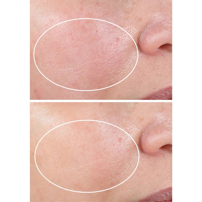 StriVectin Advanced Retinol Nightly Renewal Moisturizer, 1.0 oz, 2-pack