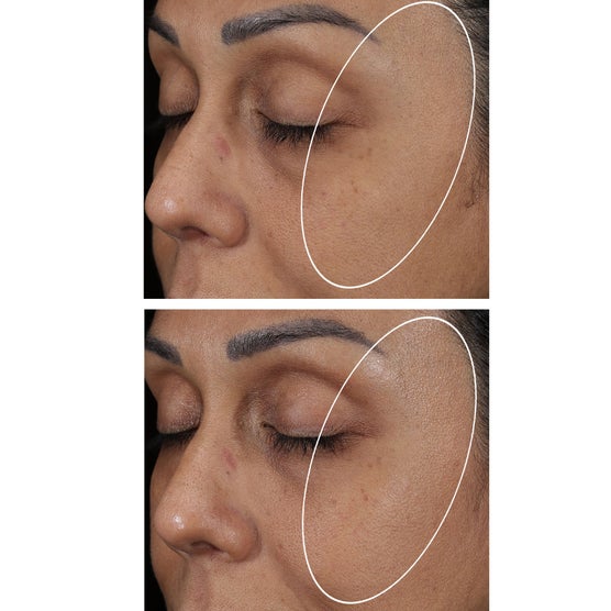 StriVectin Multi-Action Hydration Multiplier Hyaluronic Acid Serum, 1 fl oz, 2-pack