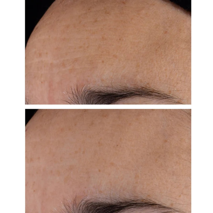 StriVectin Advanced Retinol Nightly Multi-Correct Serum, 1 fl oz, 2-pack