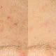 Derma E Vitamin C Serum, 1.7 fl oz, 2-pack
