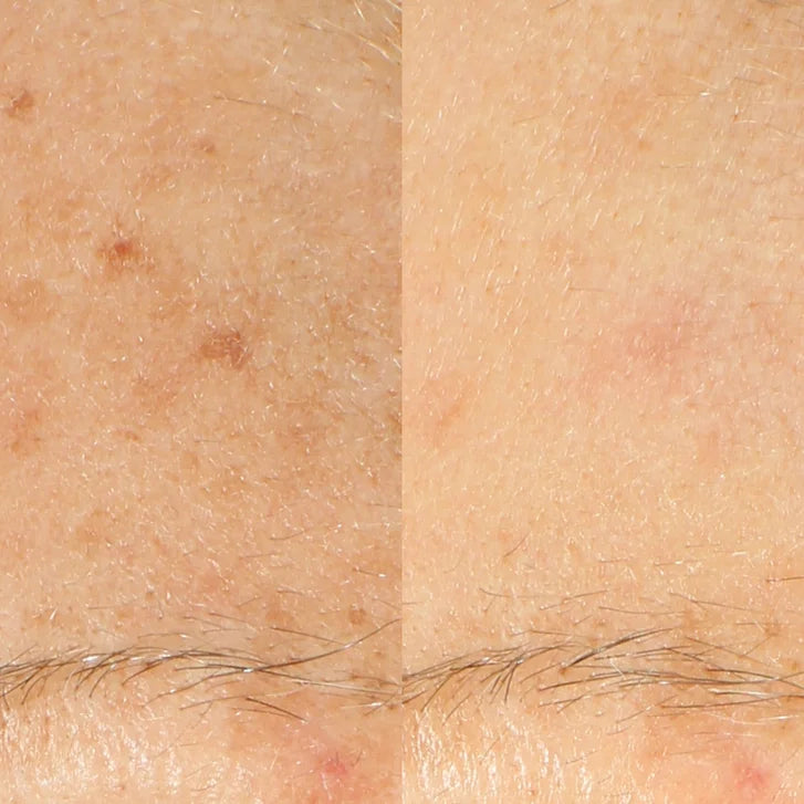 Derma E Vitamin C Serum, 1.7 fl oz, 2-pack